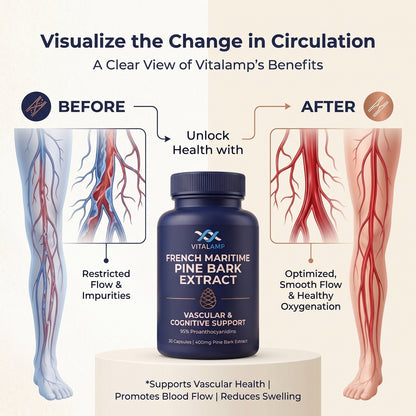 French Maritime Pine Bark Extract 400mg | 95% Proanthocyanidins | Maximum Strength Vascular & Circulation Support